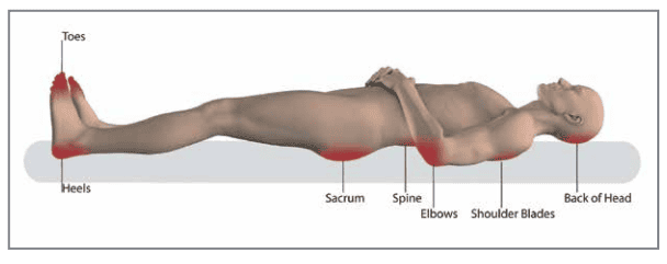 Pressure injury prevention map 13