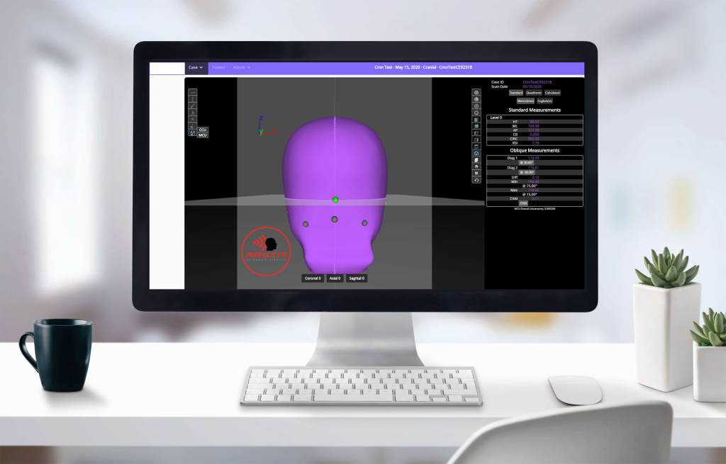 Perfect Fit head protection scan